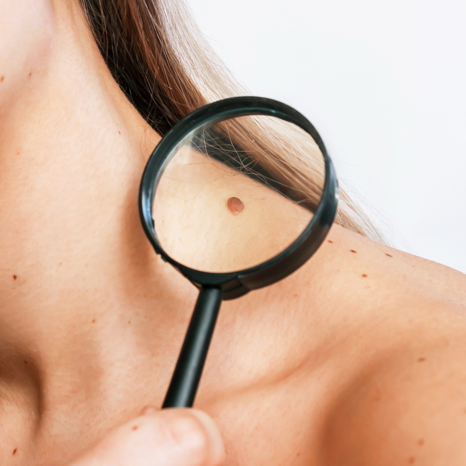 Test & accompagnement dermatologique & suivi grain de beauté, Pharmacie du Moustier, Vaux-le-Pénil